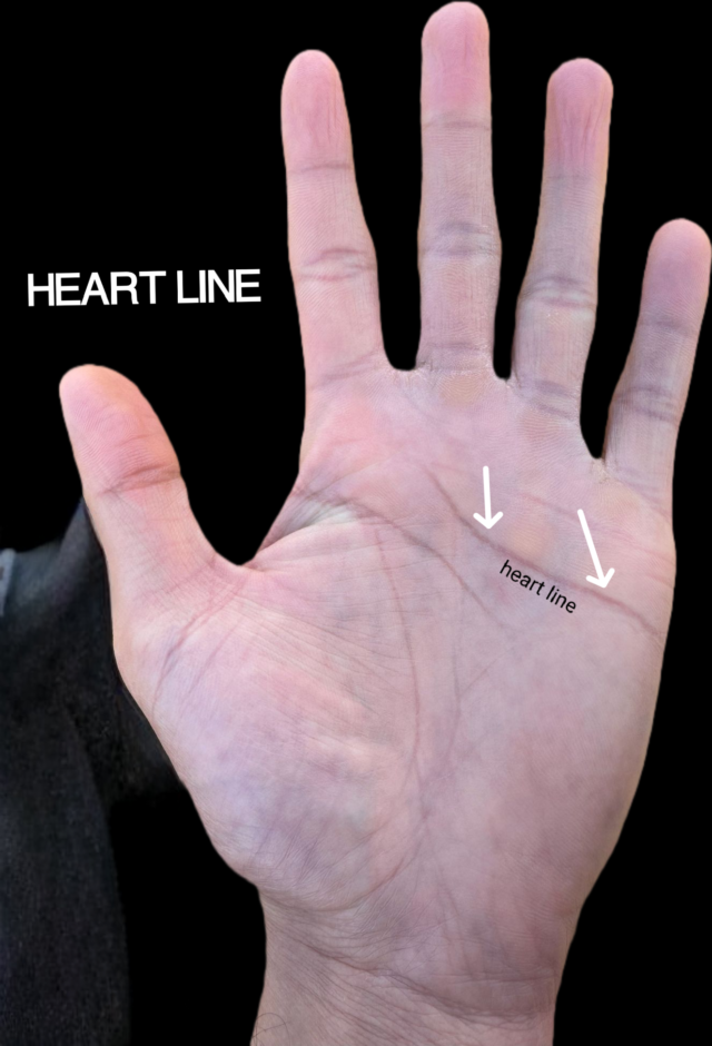 Open palm on black background showing the heart line running beneath the fingers